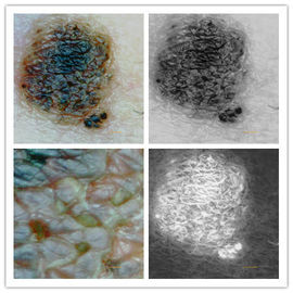 5M 화소의 해결책을 가진 피부 조사관 디지털 방식으로 현미경 피부 해석기 피부와 머릿가죽 사진기