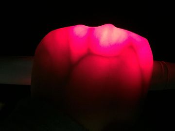 Transilluminator 정맥 거주 적외선 정맥 측정기 Safty LED 빨간불