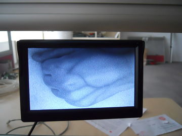 스크린 Venipuncture 휴대용 가동 가능한 장치 적외선 정맥 측정기/정맥 거주