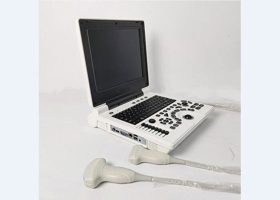 휴대용 노트북 2개의 조사 연결관을 가진 소형 방광 스캐너 색깔 초음파 체계