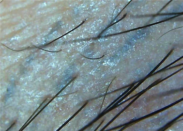 의학 검사 가득 차있는 현미경을 위한 1000x 돋보기 피부 현미경 디지털 방식으로 영상 Dermatoscope