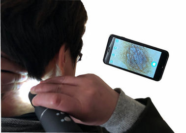 와이파이 연결 현미경 휴대용 무선 디지털 방식으로 영상 이경 피부와 머리 돋보기