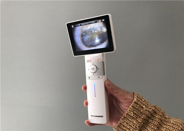 디지털 방식으로 영상 이경 Dermatoscope 및 3.5&quot;를 가진 일반적인 화상 진찰 검사 범위 풀 컬러 TFT-LCD