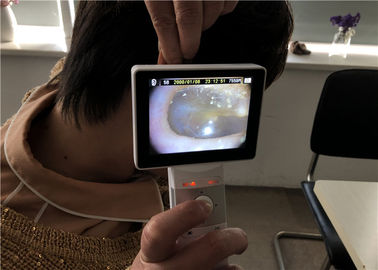 고해상을 가진 디지털 방식으로 영상 이경 Dermatoscope 소형 검안경