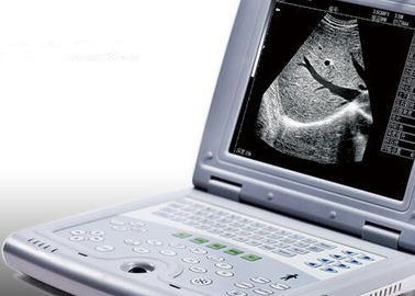 임신 휴대용 초음파 스캐너 단지 2.2kgs 무게를 위한 휴대용 초음파 기계