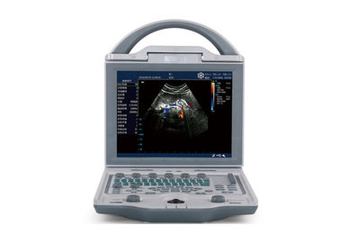 휴대용 초음파 심장 검진법 기계 10.4 인치 조정가능한 감시자를 가진 휴대용 초음파 스캐너