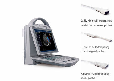 복부 볼록한 Transvaginal 변형기를 가진 휴대용 임신 초음파 스캐너
