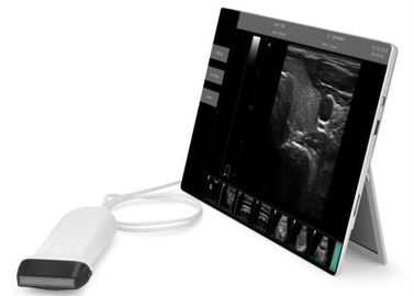 소형 초음파 진단 장비 휴대용 초음파 유효한 스캐너에 의하여 지원되는 창 10 수의사 사용
