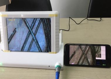 디지털 방식으로 돋보기 가동 가능한 기름 습기 안료의 자료 보고를 가진 소형 영상 Dermatoscope 피부 해석기