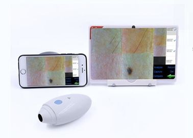 HD 디지털 방식으로 Mobilophone에 연결된 영상 Dermatoscope 피부 머리 스캐너 무선은 IOS Andriod를 지원했습니다
