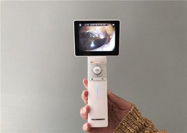 SD 카드 USB 귀 사진기 디지털 방식으로 마이크로 영상 이경 일반적인 화상 진찰 및 Dermatoscope