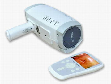 자동적인 전자 셔터를 가진 렌즈 해결책 800000 화소 디지털 방식으로 전자 Colposcope 3.5 인치 소형 스크린
