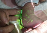 체계에게 아이들을 위한 소형 적외선 정맥 측정기 거주 Transilluminator 정맥 구경꾼을 보여주는 정맥