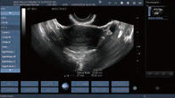 Transvaginal 조사 임신을 위한 이동할 수 있는 색깔 도풀러 초음파 스캐너