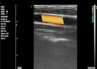 임신 8 황산 트리글리신 3.5~10 마하즈를 위한 컬러 초음파 기계 홈 초음파 스캐너 휴대용 초음파