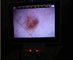 Lcd는 디지털 방식으로 인체의 임상 검사를 위한 영상 이경 검안경을 감시합니다