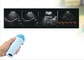 휴대용 방광 휴대용 스캐너 마이크로 볼록 프로브 초음파 수의학 임신
