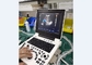 휴대용 초음파 진단 기계 노트북 프로브 컬러 도플러 장비