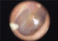 처분할 수 있는 귀덮개 귀 눈 인후를 위한 유효한 의학 휴대용 이경 내시경