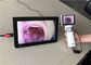 휴대용 이경 검안경 진료소를 위한 SD 카드 출력을 가진 영상 인후 사진기 Dermatoscope
