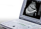 임신 휴대용 초음파 스캐너 단지 2.2kgs 무게를 위한 휴대용 초음파 기계
