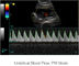 아이패드 500G 이미지 저장을 가진 초음파 진단 장치 휴대용 초음파 스캐너