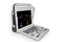 디지털 방식으로 초음파 스캐너 선택 휴대용 UItrasound 스캐너 4D 심장 조사