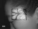 터치스크린 Transilluminator 깊이 10 mm를 가진 적외선 정맥 거주 발견자 화상 진찰