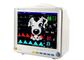휴대용 참을성 있는 감시자 애완 동물 참을성 있는 감시자 기계 동물 수의사 동물성 부속품을 가진 참을성 있는 측정 설비