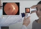 보도를 위한 45 도 선택적 와이파이 소프트웨어의 안과학 디지털 안저촬영기 시야각에서 원격 의료