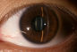 3.5 인치는 이용 가능한 화면 의학 디지털 눈 체계 디지털 안저촬영기 앞선 도 부착을 접촉합니다