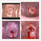 자궁 경부 Eealier의 질병을 찾아내는 질 사진기 디지털 방식으로 전자 Colposcope
