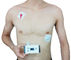 조정가능한 매개변수 심혼 배려를 위한 마이크로 보행 Portable ECG 장치