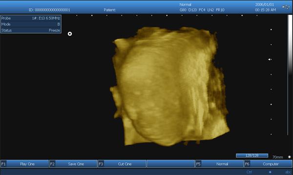 3D 디지털 방식으로 노트북 B/W 볼록한 선형 Transvaginal 조사를 가진 휴대용 초음파 스캐너