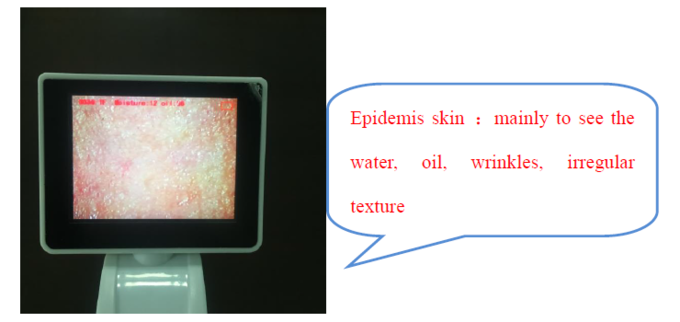 의사를 위한 세륨 BS5SH 디지털 방식으로 피부 해석기 디지털 방식으로 피부 습기 미터