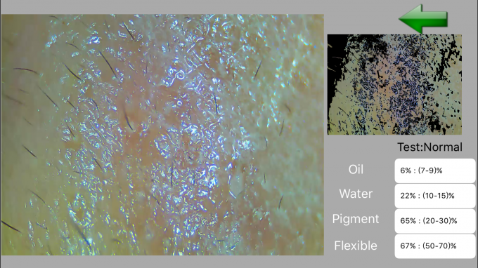 자외선 고해상을 가진 소형 디지털 방식으로 피부 해석기 피부와 머릿가죽 분석 장치