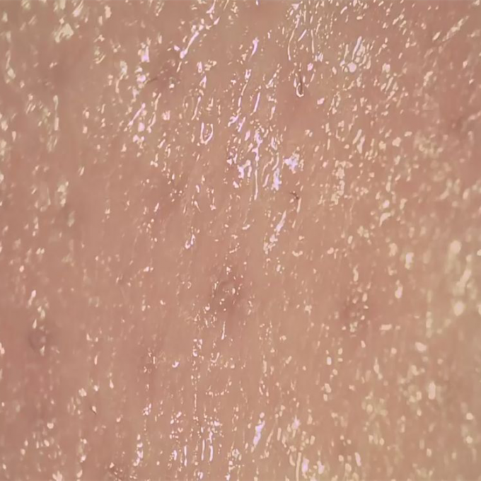 피부 습기 발견자 피부 Derm 숨구멍의 표면을 관찰하는 무선 디지털 방식으로 피부 해석기
