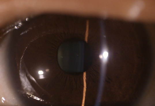 3 렌즈 이용 가능한 눈 장비 디지털 안저촬영기 눈 표면 카메라 눈 앞선 렌즈 치환성