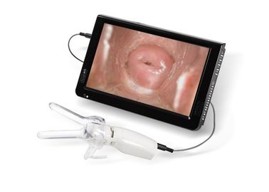 텔레비젼 또는 PC에 연결되는 Examintion 자궁 경관 질 사진기를 위한 소형 Colposcope