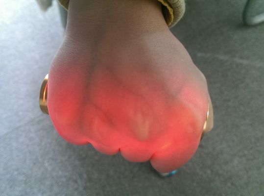 휴대용 관 영사기 Venipuncture 적외선 정맥 측정기 정맥 거주 황금 알루미늄