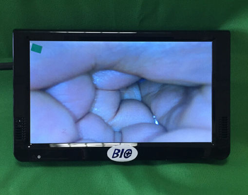 휴대용 디지털 전자 콜포스코프