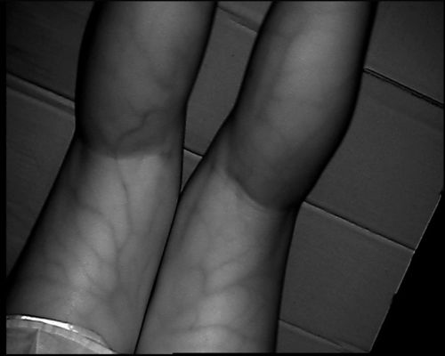 손 팔 다리를 위한 3.5Inch 스크린을 가진 고해상 800X480 테이블 유형 정맥 거주 장치