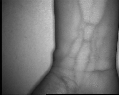 손 팔 다리를 위한 3.5Inch 스크린을 가진 고해상 800X480 테이블 유형 정맥 거주 장치