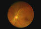 눈 광학 장비 인후 사진기 2백만개의 화소를 가진 영상 이경 Dermatoscope 디지털 방식으로 내시경