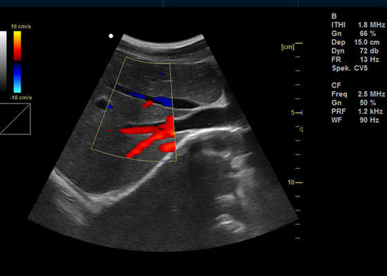 15 인치 가득 차있는 디지털 방식으로 색깔 도풀러 기계 2 usb 포트를 가진 휴대용 도풀러 화상 진찰 초음파