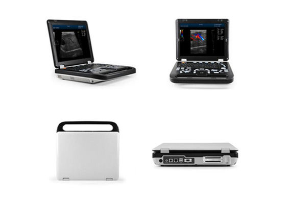 15 인치 LED 2개의 조사 연결을 가진 진단 인간적인 색깔 도풀러 기계 초음파 스캐너