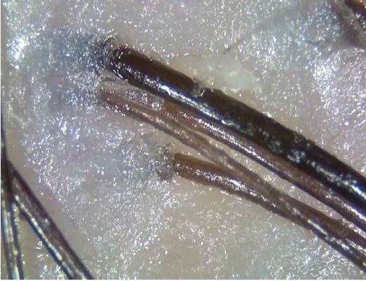 휴대용 무선 디지털 방식으로 피부 해석기 Telemedicine 진단 장치는을 가진 빛을 극화합니다