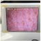 아이패드에서 표시하는 사진을 가진 백색 와이파이 피부 습기 검수원 피부 습기 감지기