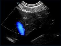 미니 주머니 휴대용 초음파 스캐너