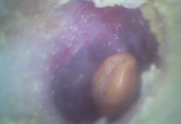 32G의 극소 SD 플래시 카드와 가지고 다닐 수 있는 ENT 범위 경제적 포켓용 디지털 영상 이경